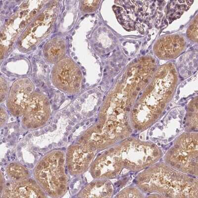 Immunohistochemistry-Paraffin: GALM Antibody [NBP2-38252]
