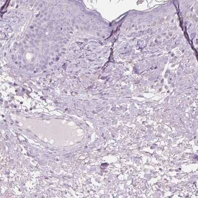 Immunohistochemistry-Paraffin: GALM Antibody [NBP2-38252]