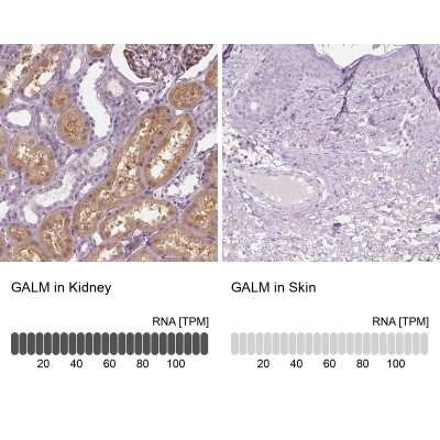 Immunohistochemistry-Paraffin: GALM Antibody [NBP2-38252]