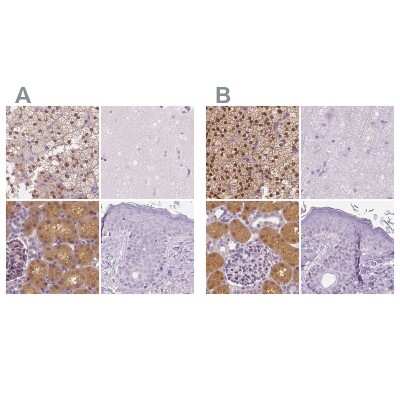 Immunohistochemistry-Paraffin: GALM Antibody [NBP2-38252]