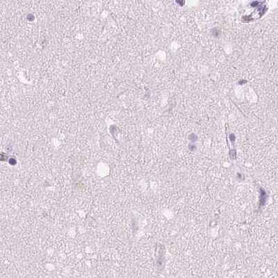 Immunohistochemistry-Paraffin: GALM Antibody [NBP2-38252]