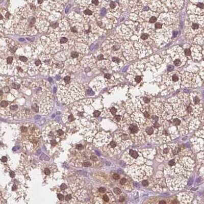 Immunohistochemistry-Paraffin: GALM Antibody [NBP2-38252]