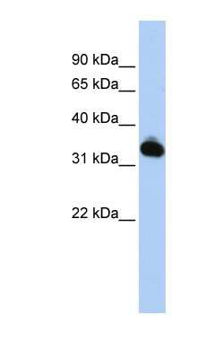 Western Blot: GALM Antibody [NBP1-56713]