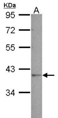 Western Blot: GALM Antibody [NBP2-16592]