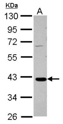 Western Blot: GALM Antibody [NBP2-16593]