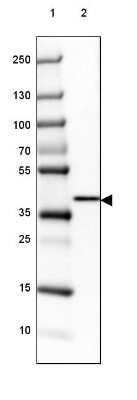 Western Blot: GALM Antibody [NBP2-38252]
