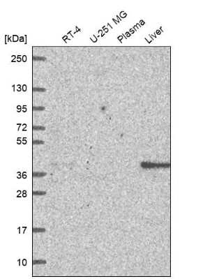 Western Blot: GALM Antibody [NBP2-62645]