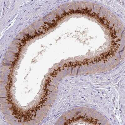 Immunohistochemistry-Paraffin: GALNT12 Antibody [NBP2-14035]