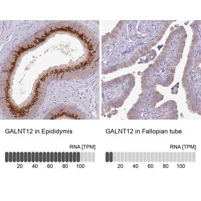 Immunohistochemistry-Paraffin: GALNT12 Antibody [NBP2-14035]