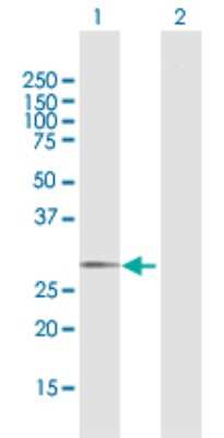 Western Blot: GALNT12 Antibody [H00079695-D01P]