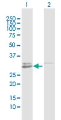 Western Blot: GALNT12 Antibody [H00079695-D02P]