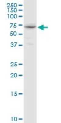 Western Blot: GALNT14 Antibody [H00079623-D01P]