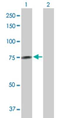 Western Blot: GALNT14 Antibody [H00079623-D01P]