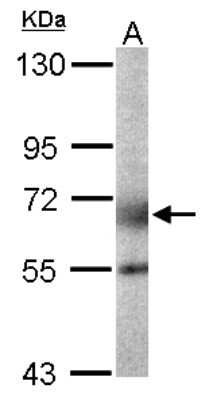 Western Blot: GALNT2 Antibody [NBP1-32394]
