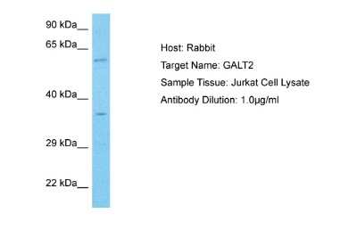 Western Blot: GALNT2 Antibody [NBP2-87483]