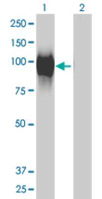 Western Blot: GALNT6 Antibody (4C10) [H00011226-M01]