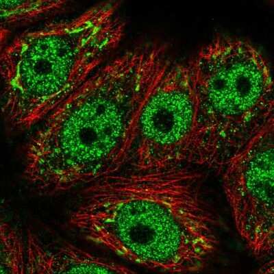 Immunocytochemistry/ Immunofluorescence: GALNT6 Antibody [NBP1-86059]