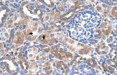 Immunohistochemistry: GALNT6 Antibody [NBP1-69641]