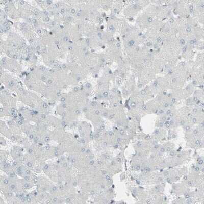 Immunohistochemistry-Paraffin: GALNT6 Antibody [NBP1-86100]