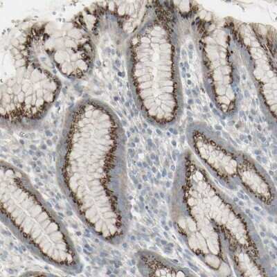Immunohistochemistry-Paraffin: GALNT6 Antibody [NBP1-86100]