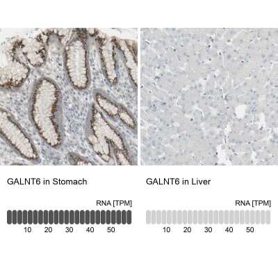 Immunohistochemistry-Paraffin: GALNT6 Antibody [NBP1-86100]