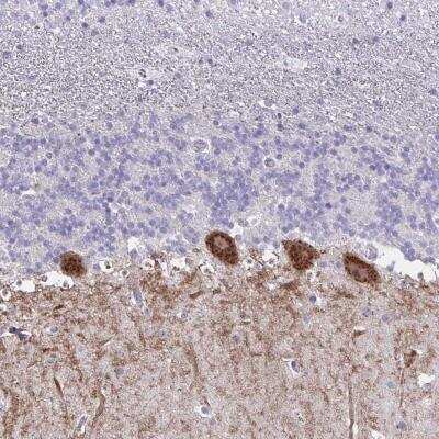 Immunohistochemistry-Paraffin: GALNTL1 Antibody [NBP2-31747]