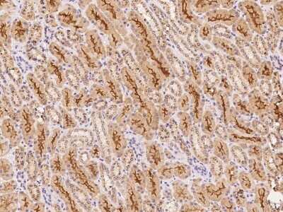 Immunohistochemistry: GALNTL4 Antibody [NBP3-06635]