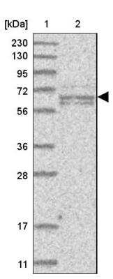 Western Blot: GALNTL6 Antibody [NBP1-81845]