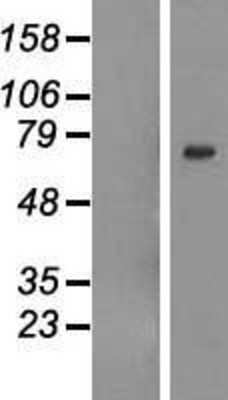 Western Blot: GALNTL6 Overexpression Lysate [NBL1-10954]