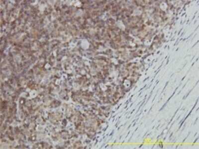 Immunohistochemistry-Paraffin: GALT Antibody (4C11) [H00002592-M01]