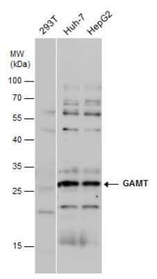 Western Blot: GAMT Antibody [NBP3-12967]