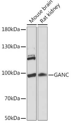 Western Blot: GANC AntibodyAzide and BSA Free [NBP3-03889]