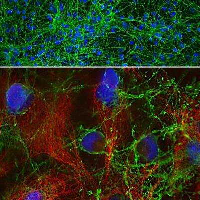 Immunocytochemistry/ Immunofluorescence: GAP-43 Antibody [NB300-143]
