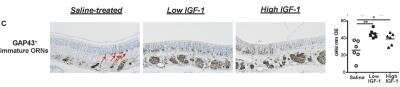 Immunohistochemistry: GAP-43 Antibody [NB300-143]