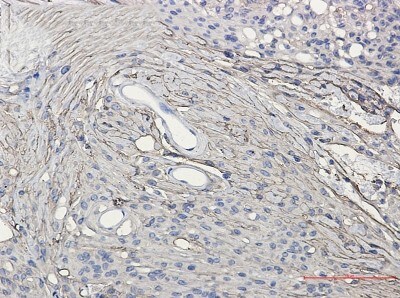 Immunohistochemistry-Paraffin: GAP-43 Antibody (S01-4F6) [NBP3-20078]