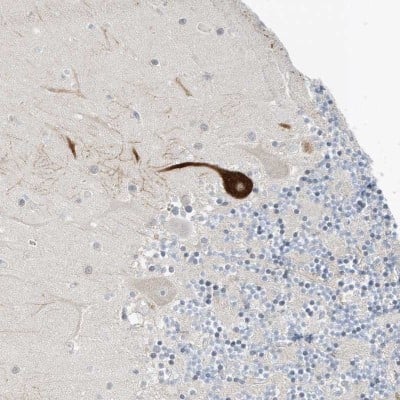 Immunohistochemistry: GAP1m Antibody [NBP2-32019]