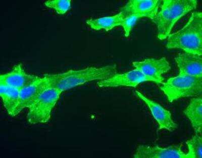 Immunocytochemistry/Immunofluorescence Staining of GAPDH in SH-SY5Y Cells