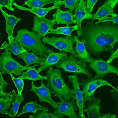 Immunocytochemistry/Immunofluorescence Staining of GAPDH in HeLa Cells