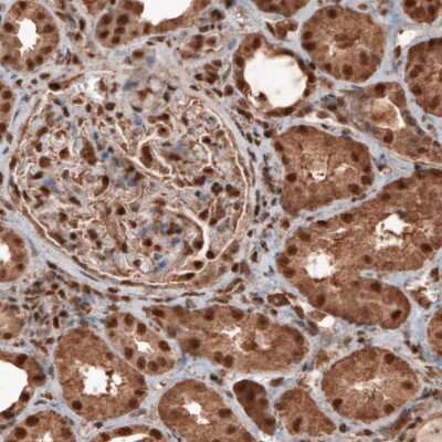 Immunohistochemistry: GAPDH Antibody (CL3266) [NBP2-59779]