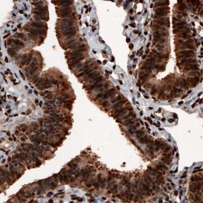 Immunohistochemistry: GAPDH Antibody (CL3266) [NBP2-59779]