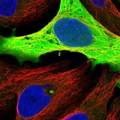 Immunocytochemistry/ Immunofluorescence: GAPDH Antibody [NBP2-56153]