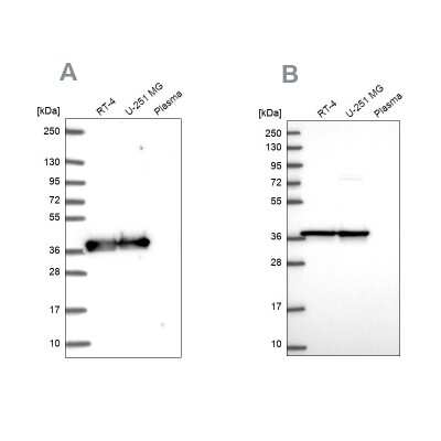 Western Blot: GAPDH Antibody [NBP2-56153]