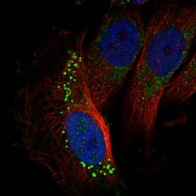 Immunocytochemistry/ Immunofluorescence: GARNL3 Antibody [NBP1-90799]