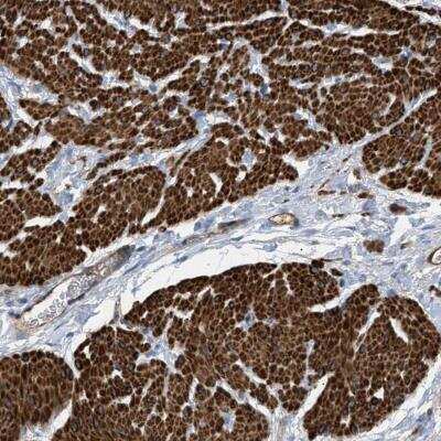 Immunohistochemistry: GARNL3 Antibody [NBP1-90800]