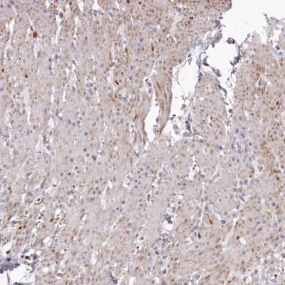 Immunohistochemistry-Paraffin: GARNL3 Antibody [NBP1-90799]