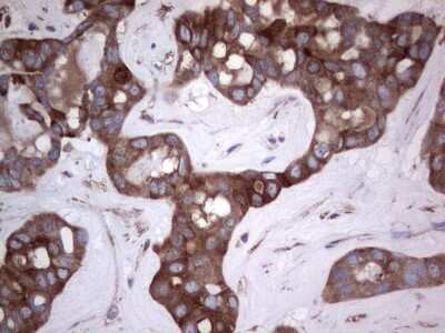 Immunohistochemistry: GARS Antibody (OTI4G4) [NBP2-45808]
