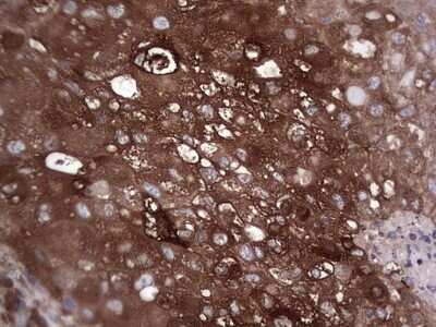 Immunohistochemistry: GARS Antibody (OTI4G4) [NBP2-45808]