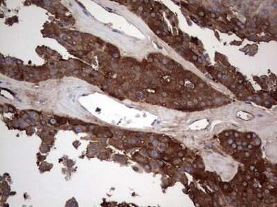Immunohistochemistry: GARS Antibody (OTI4G4) [NBP2-45808]