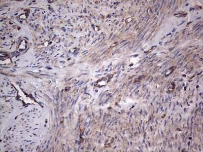 Immunohistochemistry: GARS Antibody (OTI4G4) [NBP2-45808]