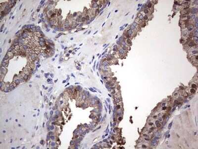 Immunohistochemistry: GARS Antibody (OTI4G4) [NBP2-45808]